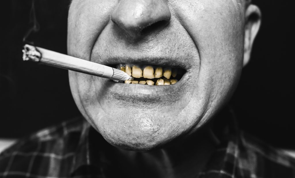 When can I smoke after a tooth extraction 